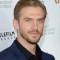 Dan Stevens Picture