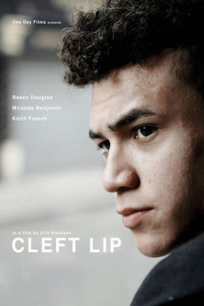 Cleft Lip (2018) download
