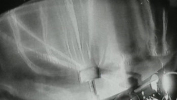 Sigur Rós: Inni (2011) download